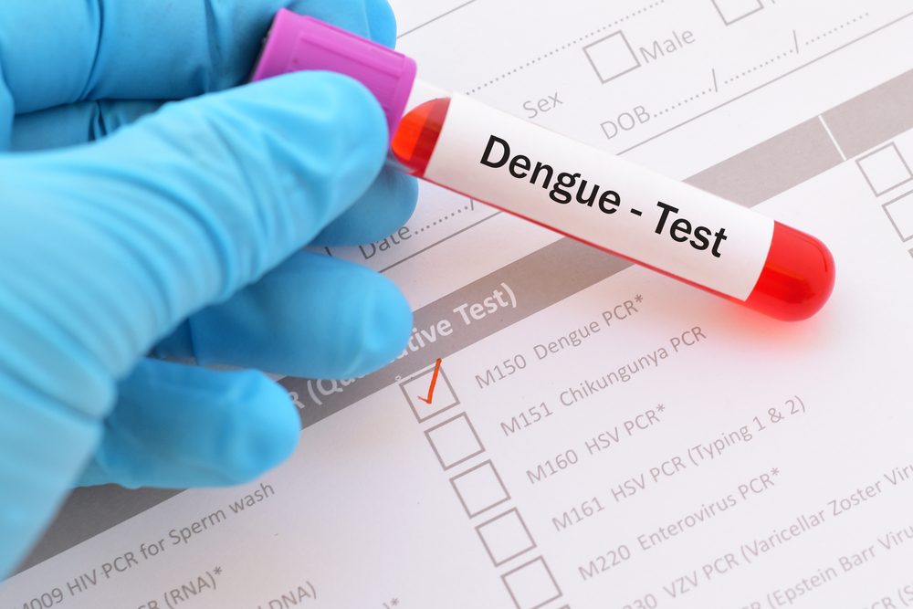 dengue allerta massima
